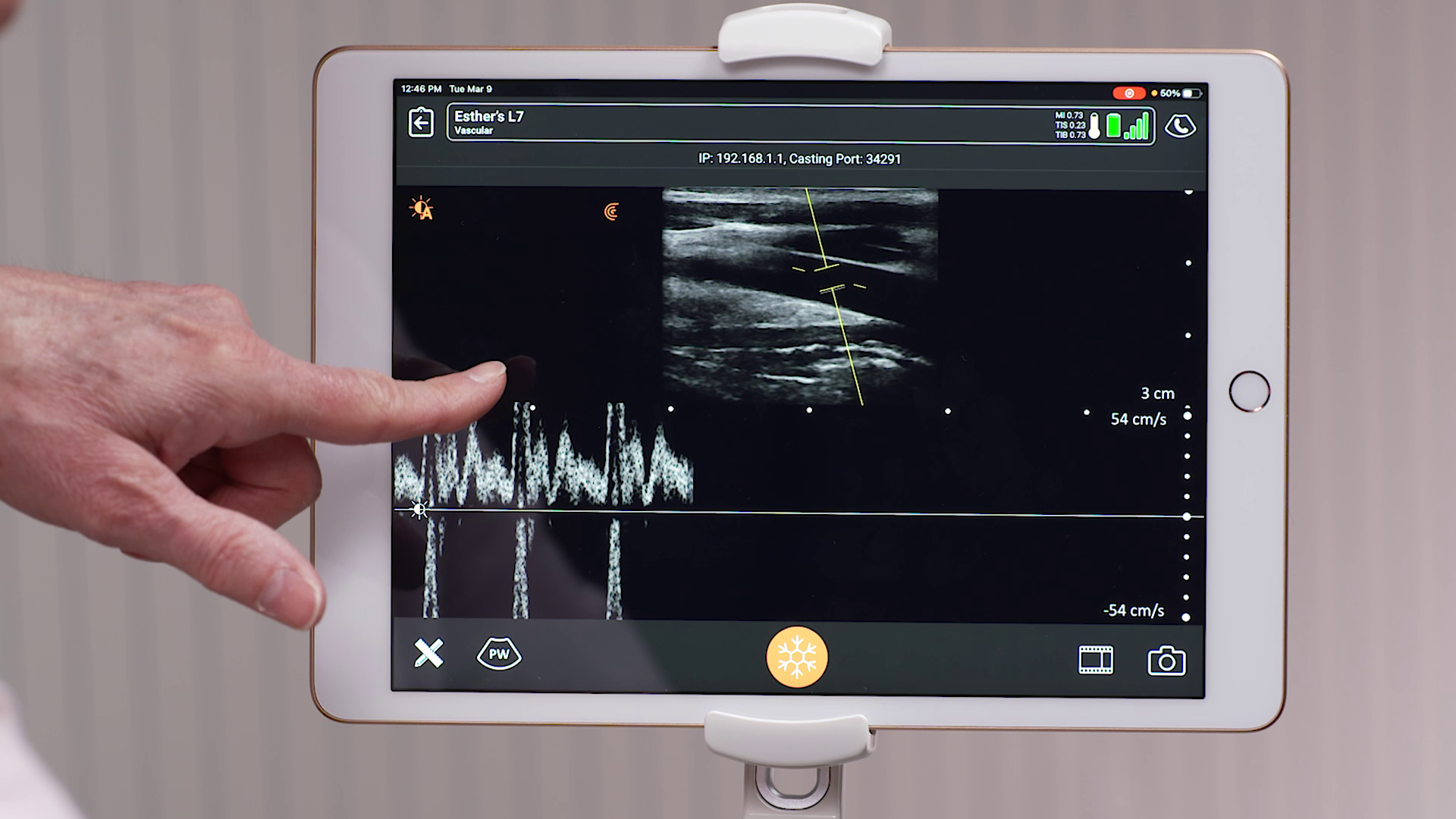 Pulsed Wave Doppler Mode Clarius Mobile Health