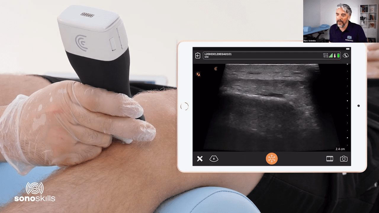 Pragmatic Msk Ultrasound Scanning The Shoulder Elbow Knee To