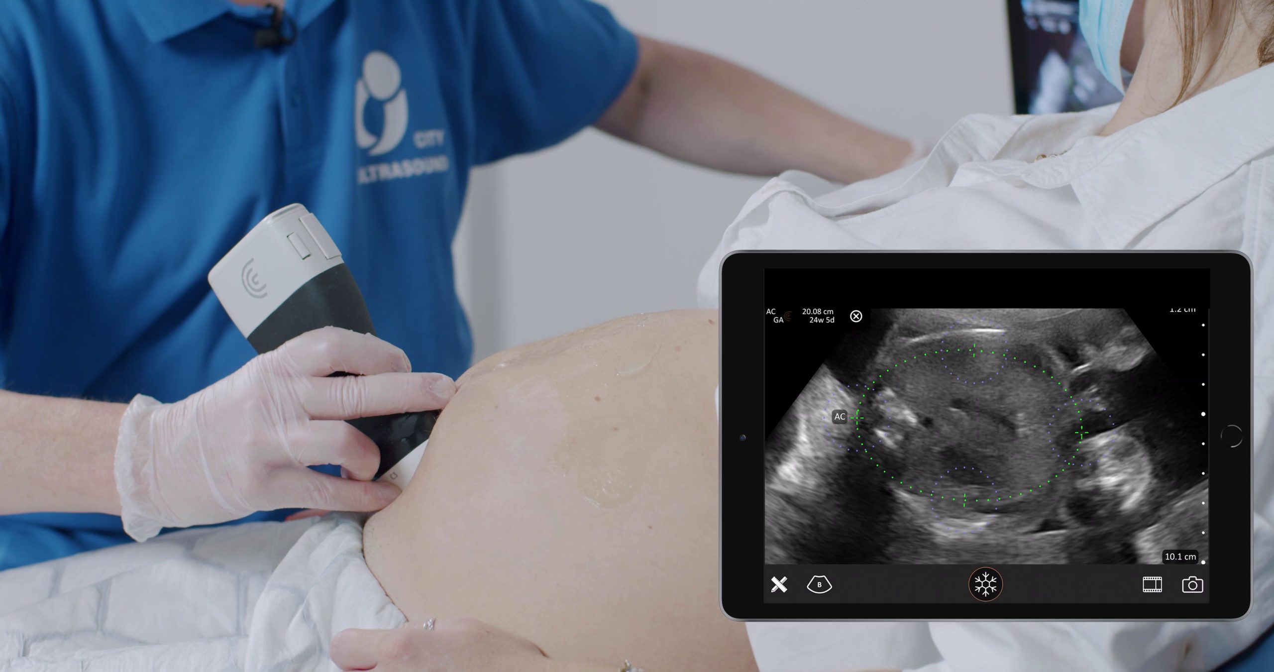 Clarius Ultrasound Webinar Second Trimester Obstetric Scans Essential