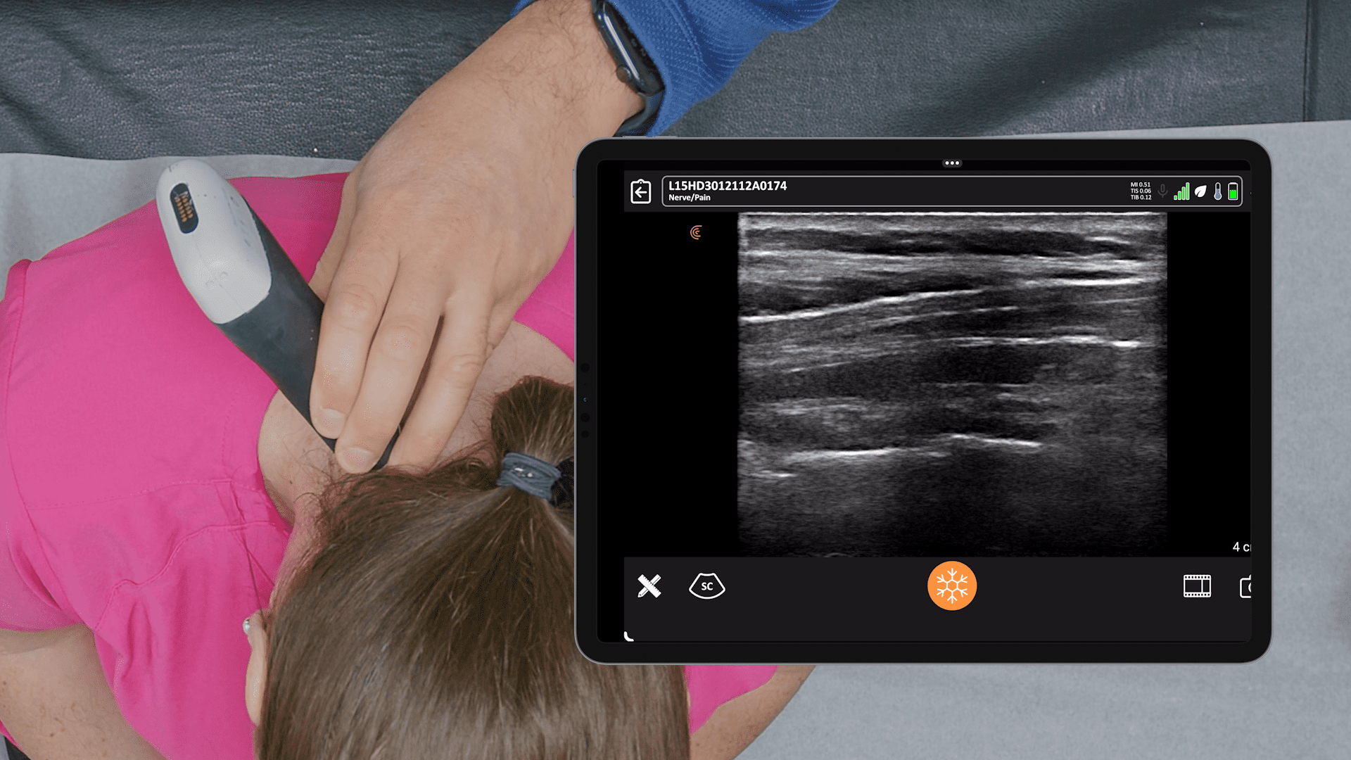 Cervical Ultrasound Anatomy Clarius