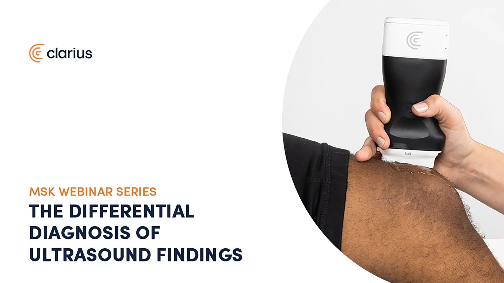 Musculoskeletal Ultrasound Imaging – The Differential Diagnosis of Ultrasound Findings