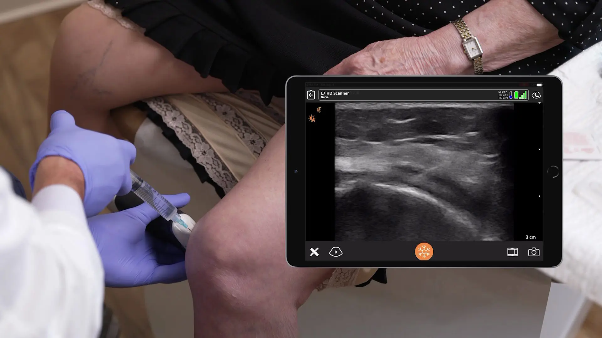 Pro Tips for Ultrasound Guided Pain Medicine Injections
