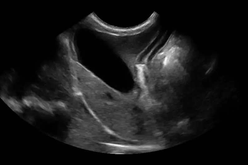 Canine Liver and Gallbladder