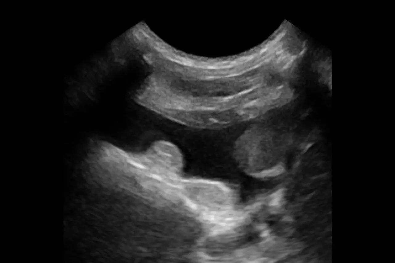 Canine Pleural Effusion 1