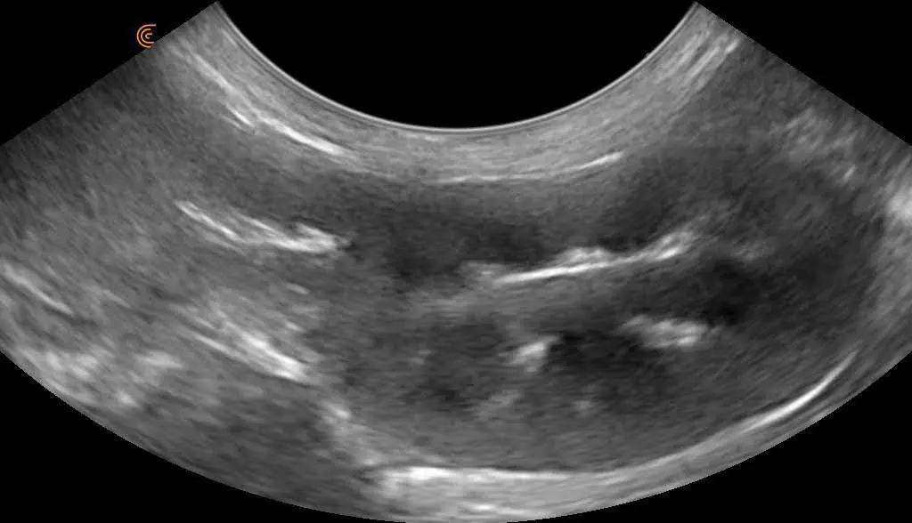 Dog Kidney