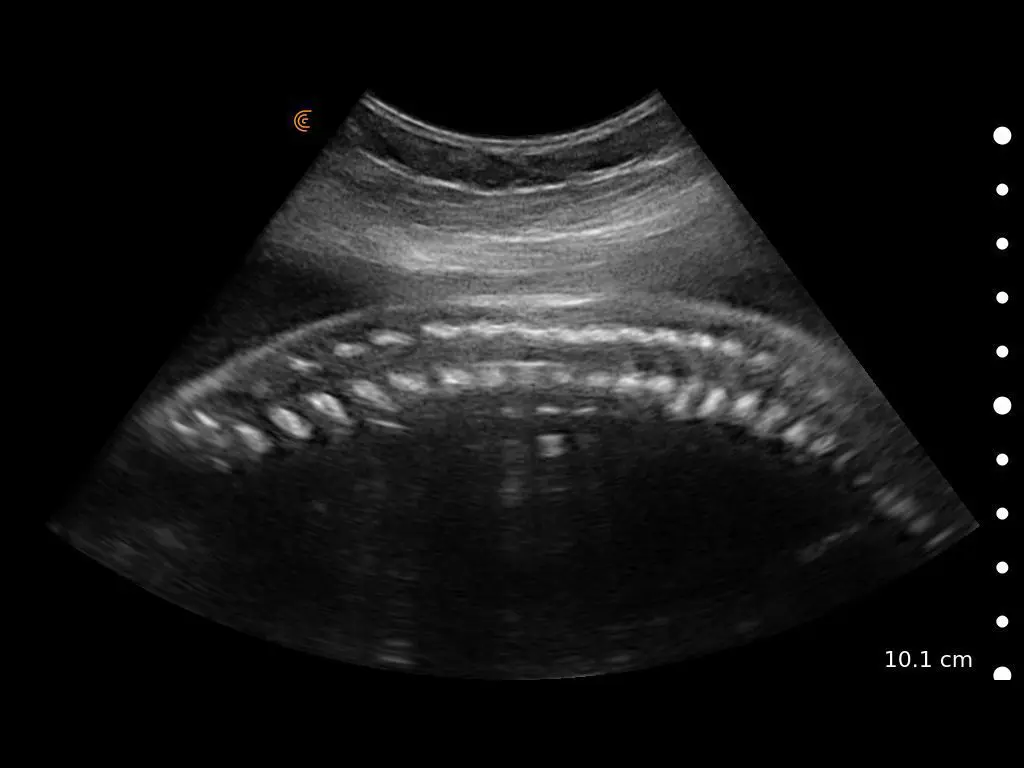 Baby Spine