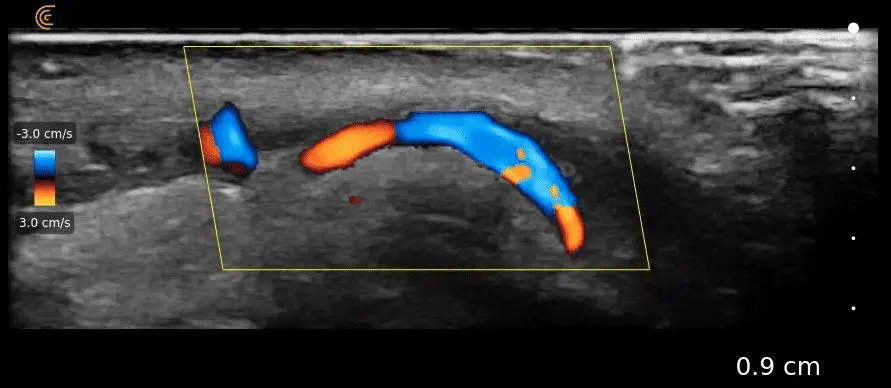 lab artery