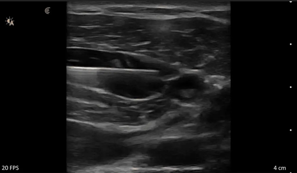 needle-2-cropped