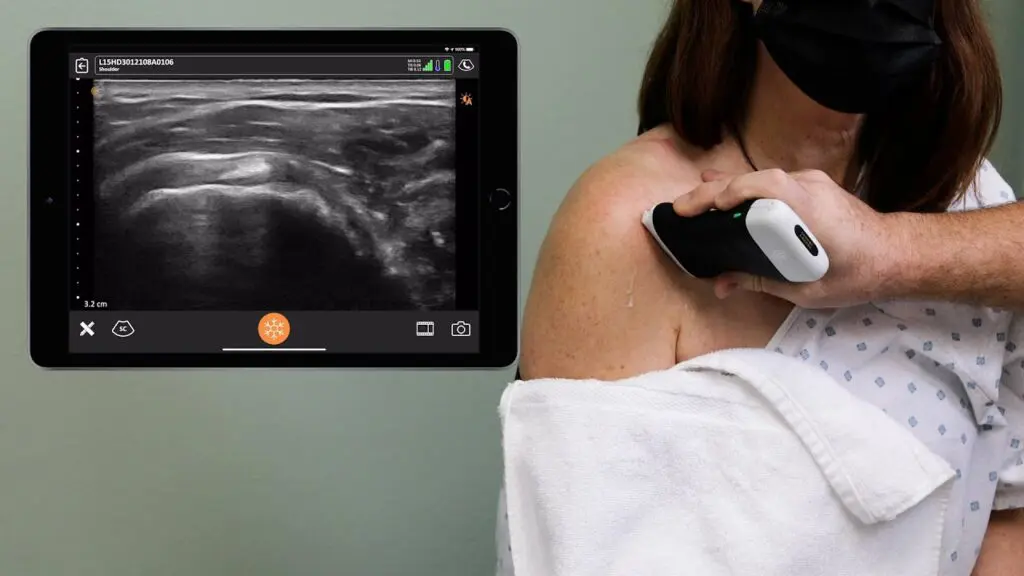 Ultrasound-Shoulder-Fritz