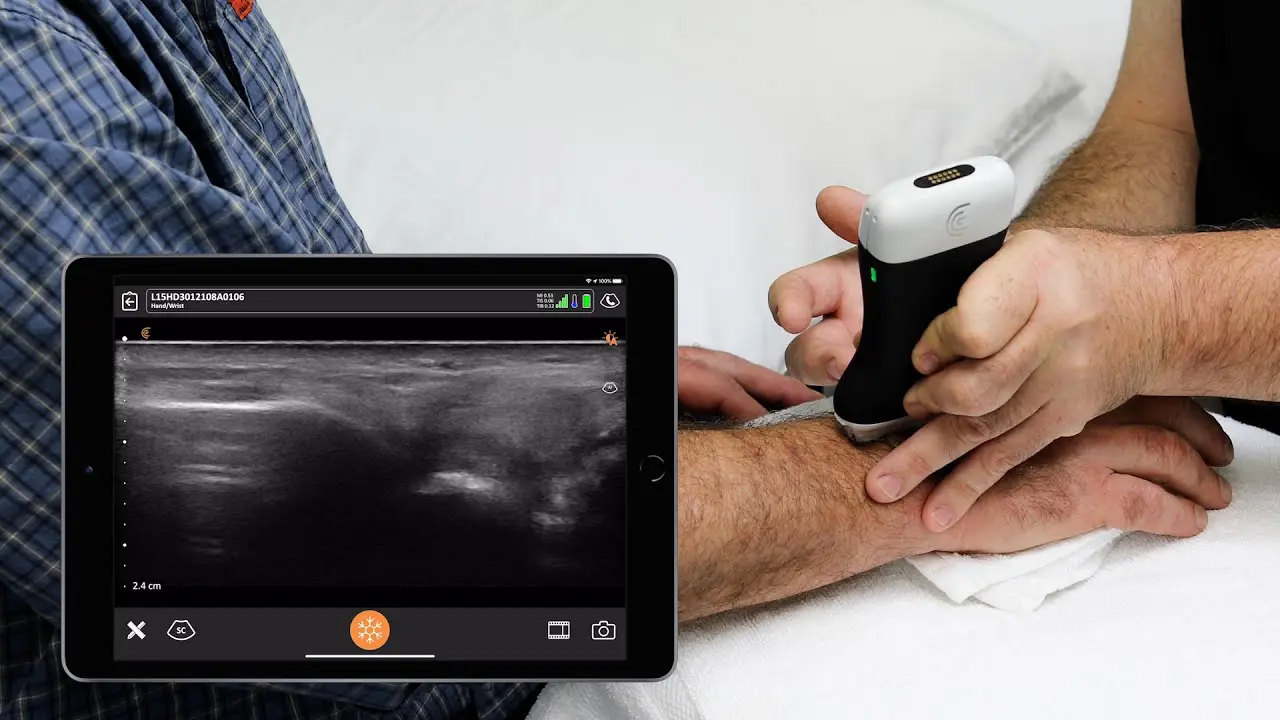 Ultrasound-Wrist-Fritz