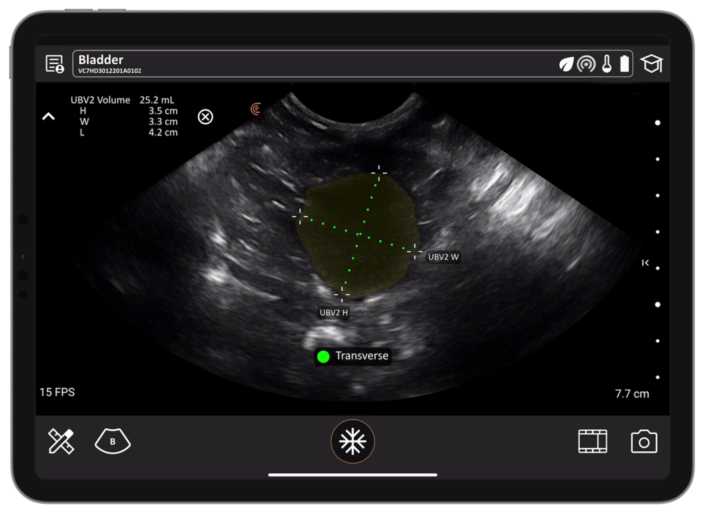 Veterinary bladder scan with AI measuring bladder volume for fast, standardized urinary assessment in companion animals