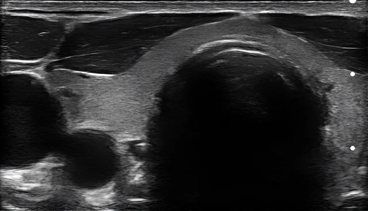 Tモード・ニーオフ