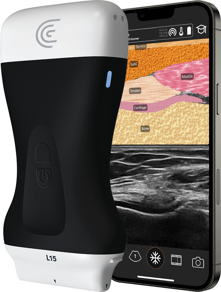 Clarius L15 wireless ultrasound scanner with a smartphone displaying T-Mode tissue layer labels for dermis, subcutaneous tissue, tendon, cartilage, muscle, and bone alongside the live ultrasound image