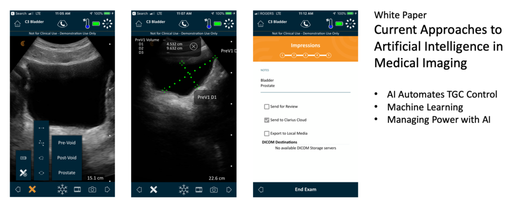 The urology workflow on the Clarius app