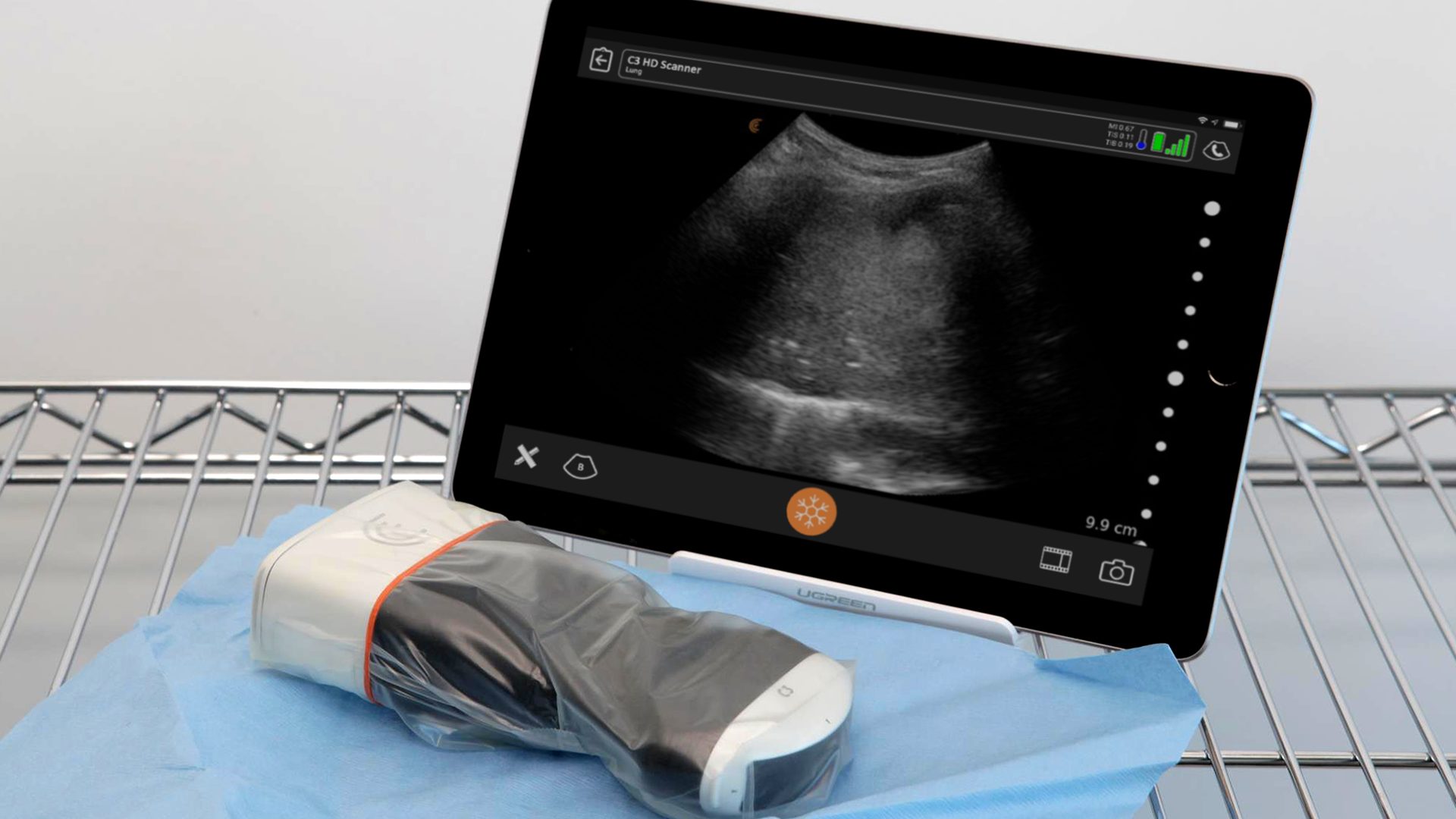 Clinical Utility and Technique for Lung Ultrasound in COVID-19 Cases