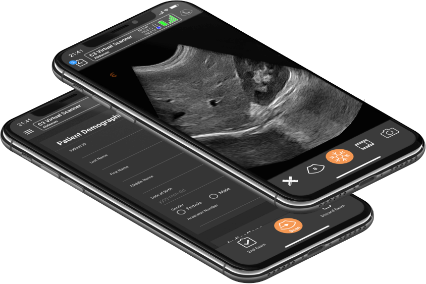 Clarius  Portable Pocket Handheld Ultrasound Scanners