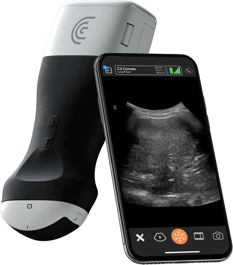 Ultrasound For Critical Care Clarius Mobile Health