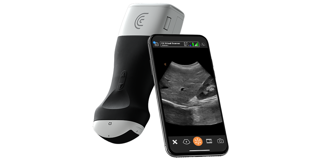 Portable Pocket Handheld Ultrasound Scanners - Clarius