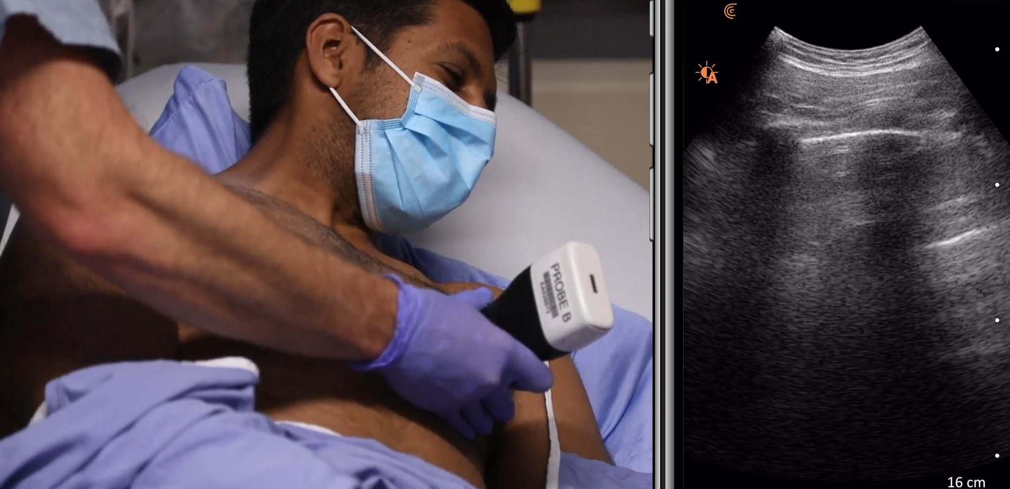 Clarius Ultrasound is Helping to Deliver Faster COVID-19 Diagnosis