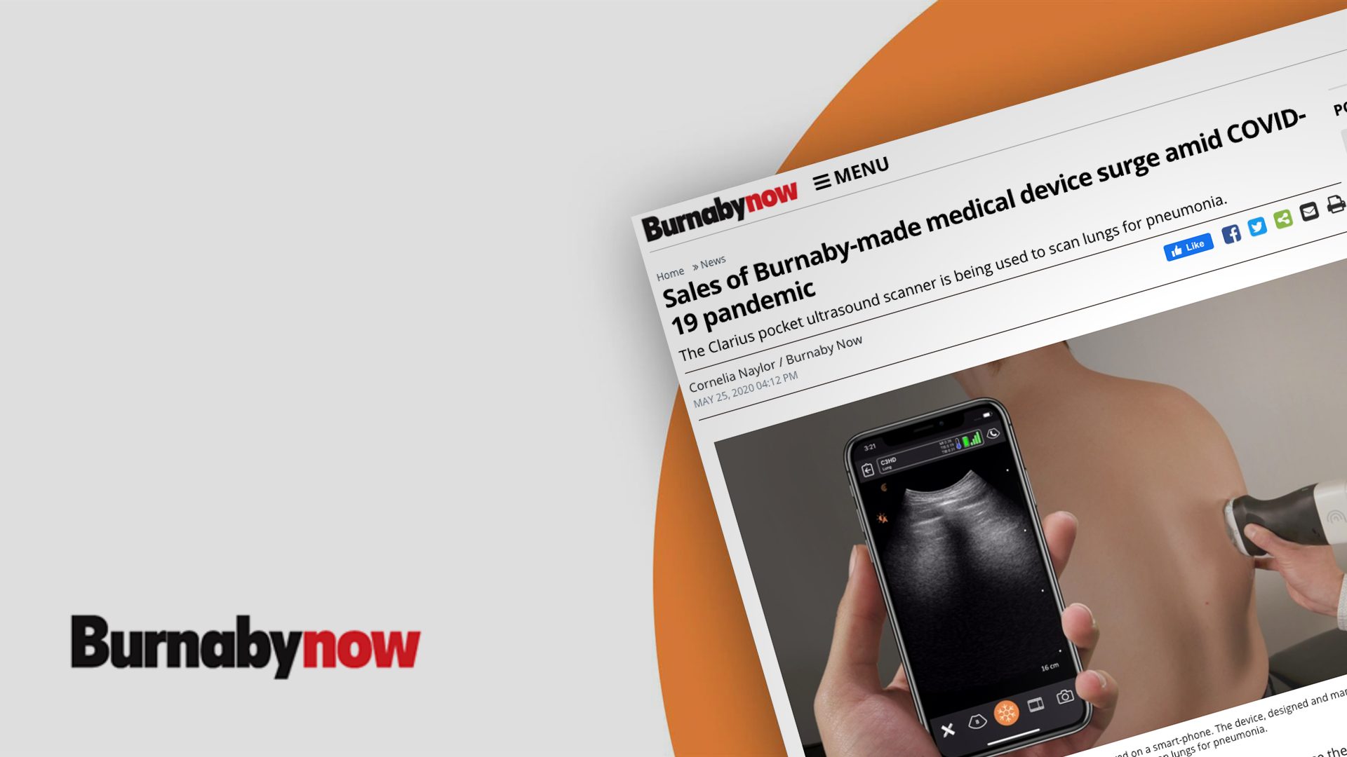 Burnaby Now covers Clarius during the COVID-19 pandemic