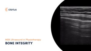 MSK Ultrasound in Physiotherapy – Bone Integrity