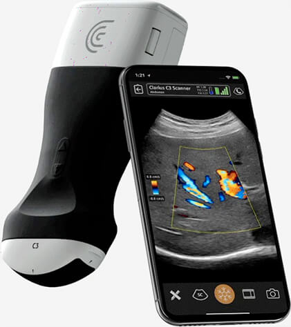 Samme Enig med Ydmyge Portable Pocket Handheld Ultrasound Scanners - Clarius