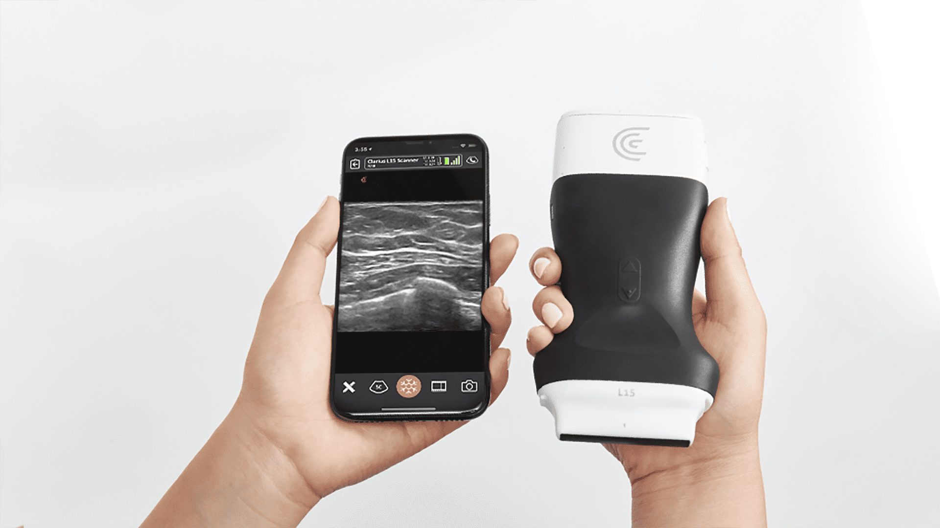 What 5 Medical Practitioners Have to Say about Clarius Image Quality