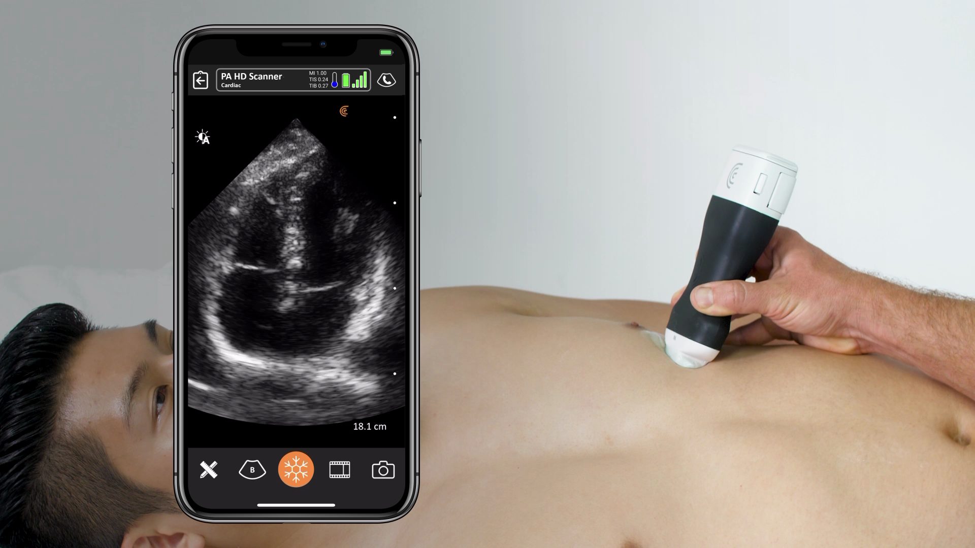 Clarius Meets Demand for High Definition Cardiac Ultrasound Imaging