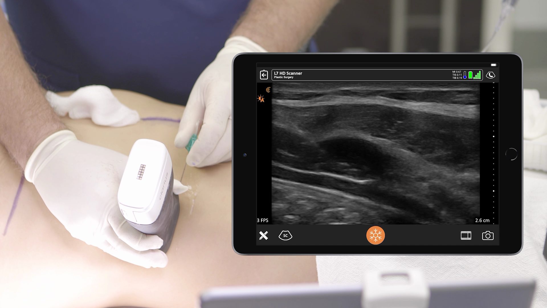 Learn Why Dr. Salzman’s Patients are Able to Go Out for Dinner After Their Plastic Surgery Procedures