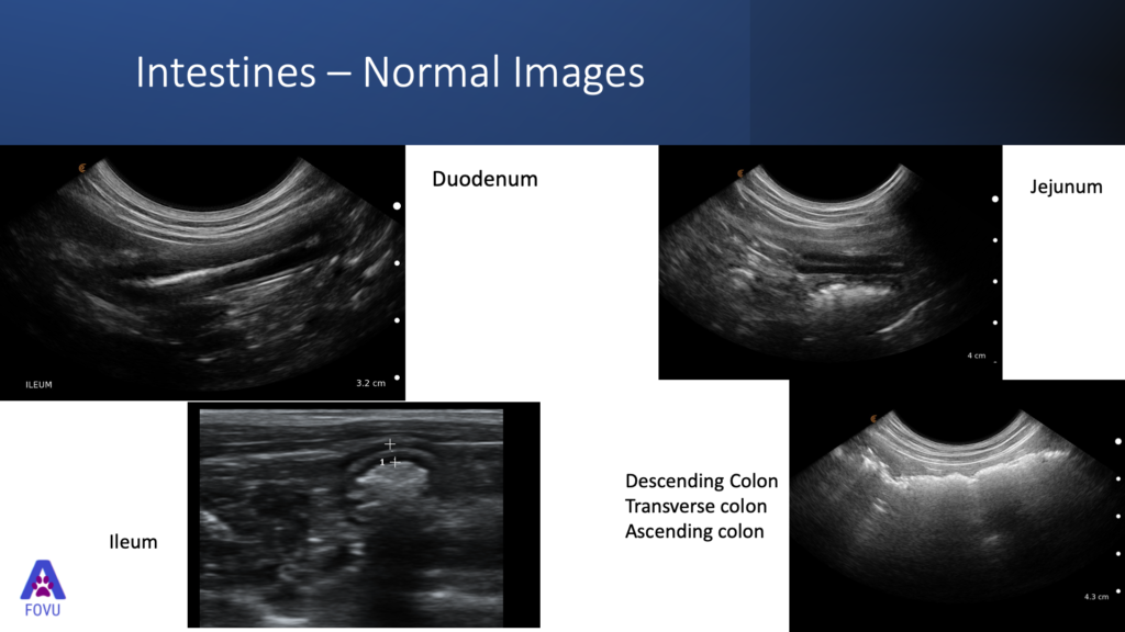 [VIDEO] Learn How to Use Ultrasound to Look for Intestinal Pathology in