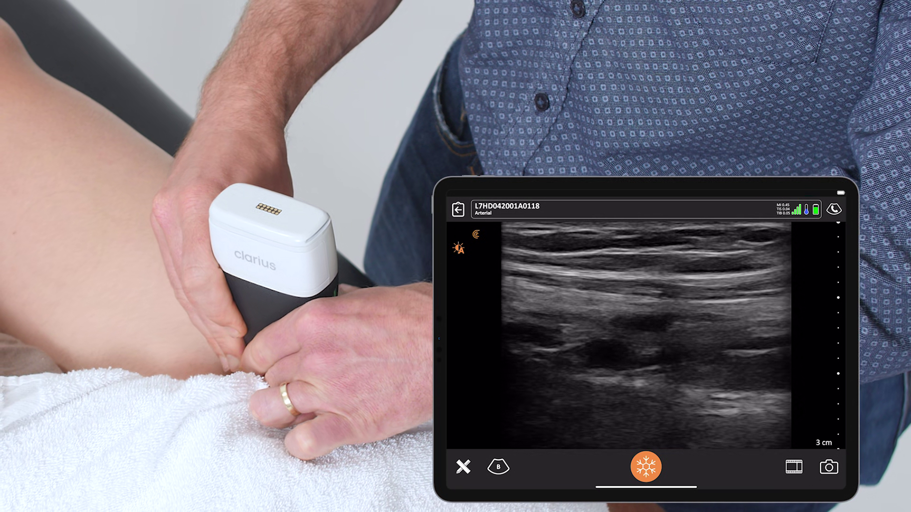 Lower Extremity Vascular Measurements - Clarius Mobile Health