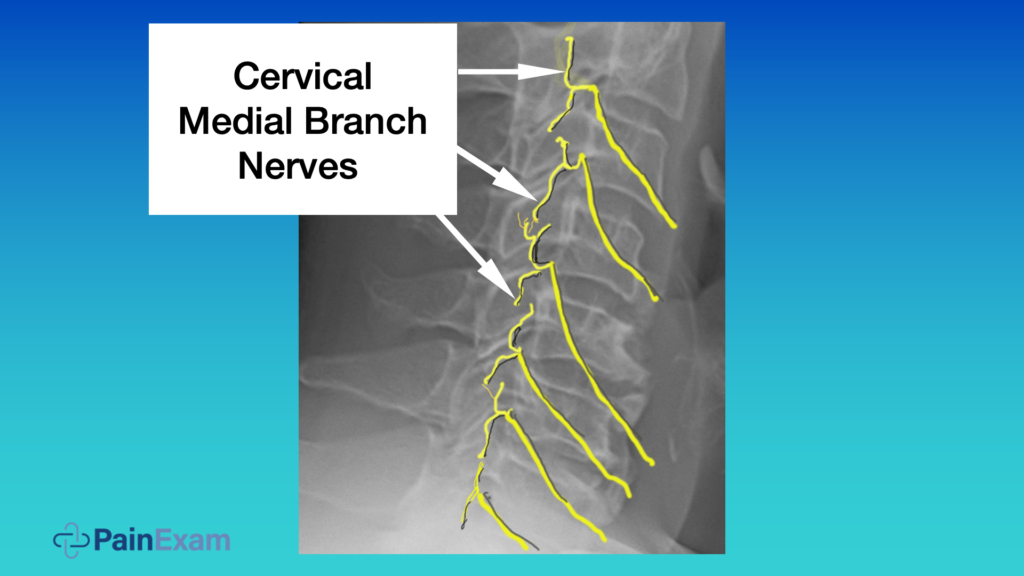 Cervical Medial Branch Block