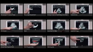 A Beginner’s Video Guide to Clarius Handheld Ultrasound
