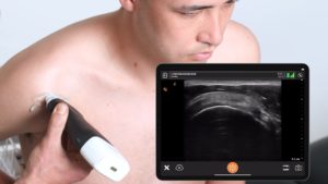 A Beginner’s Video Guide to Upper Extremity MSK Ultrasound