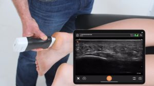 Podiatrists Report Reduced Waiting Times and More Focused Treatment From Using Ultrasound