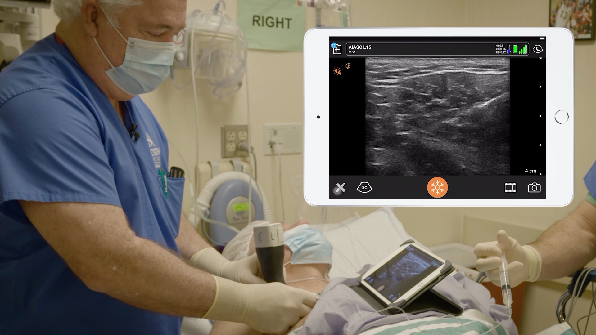 Avoid Systemic Opioids and Improve Postoperative Pain Control with a PEC 1 Block for Shoulder Surgeries