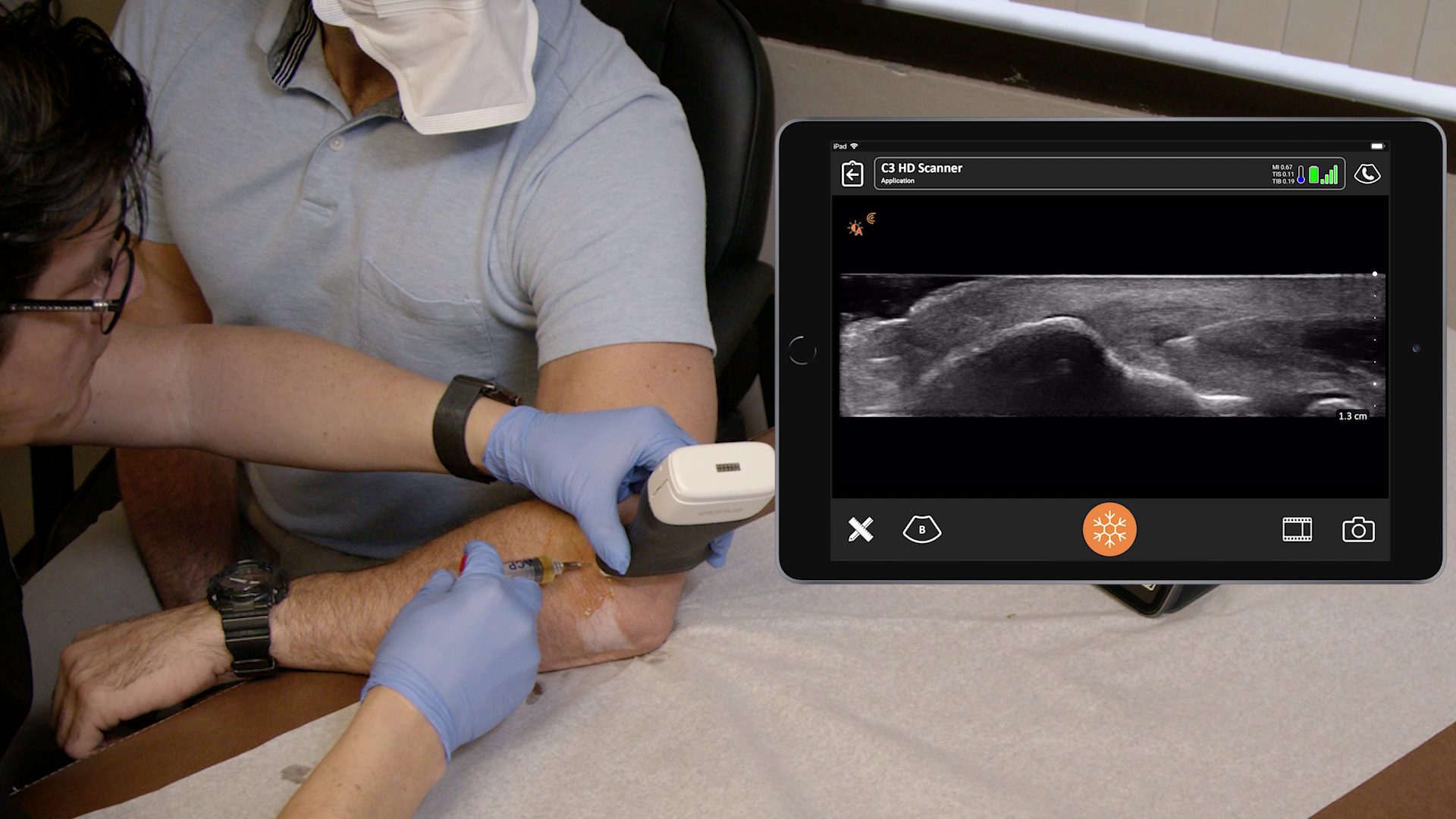 Visualize Your Needle Ultrasound for Painless and Accurate MSK