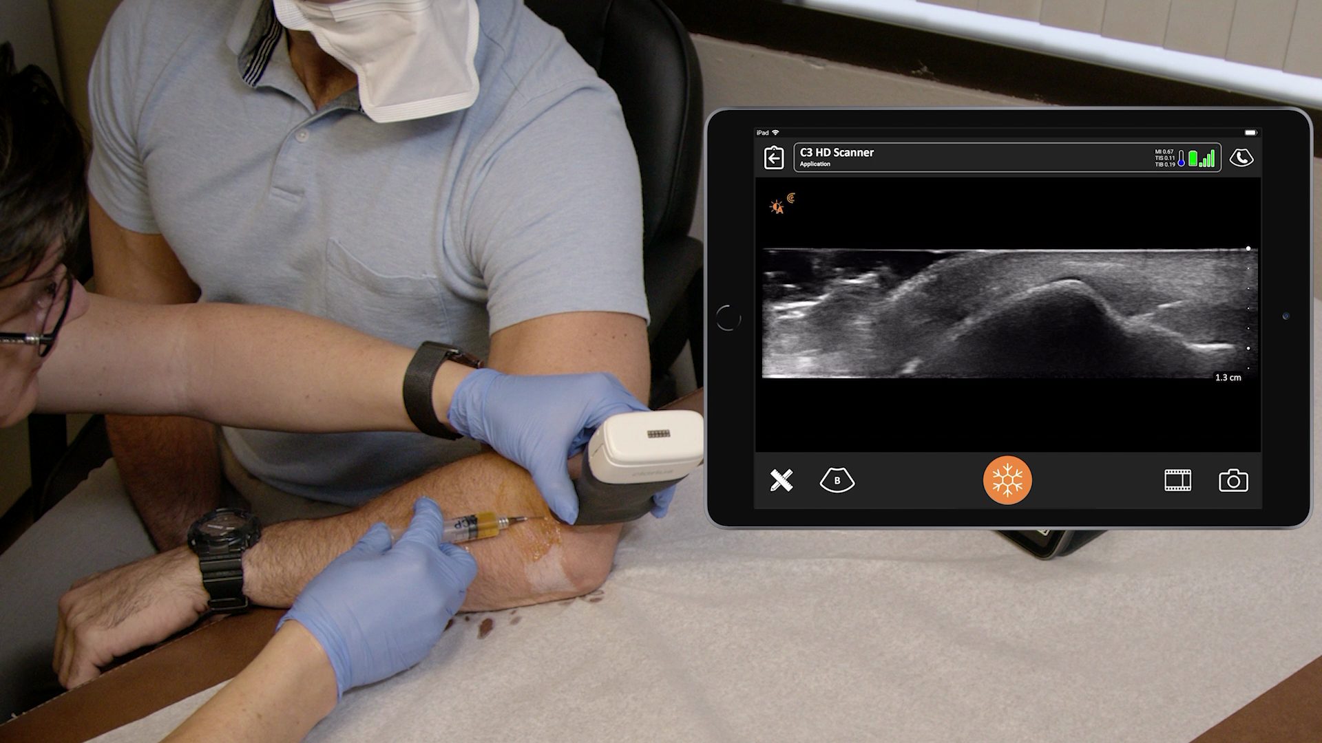 Ultrasound Guidance for New Orthopaedic Treatment Options Like PRP ...