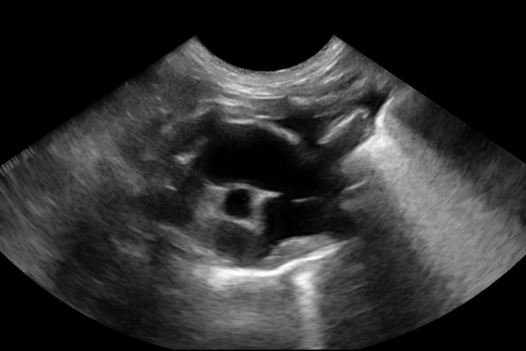 Canine Pleural Effusion 2