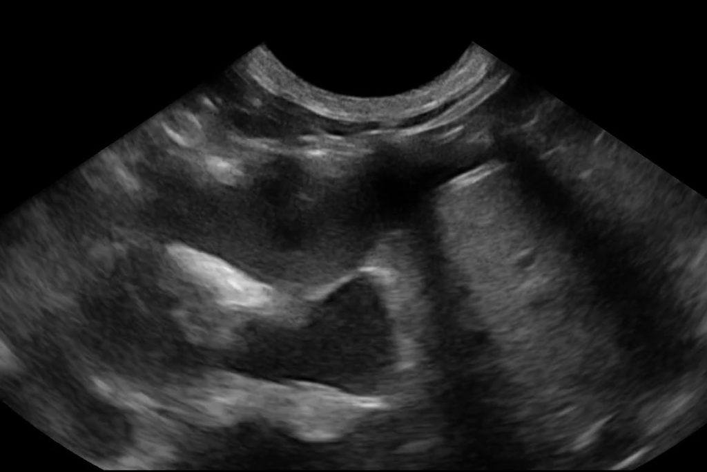 Canine Pleural Effusion 3