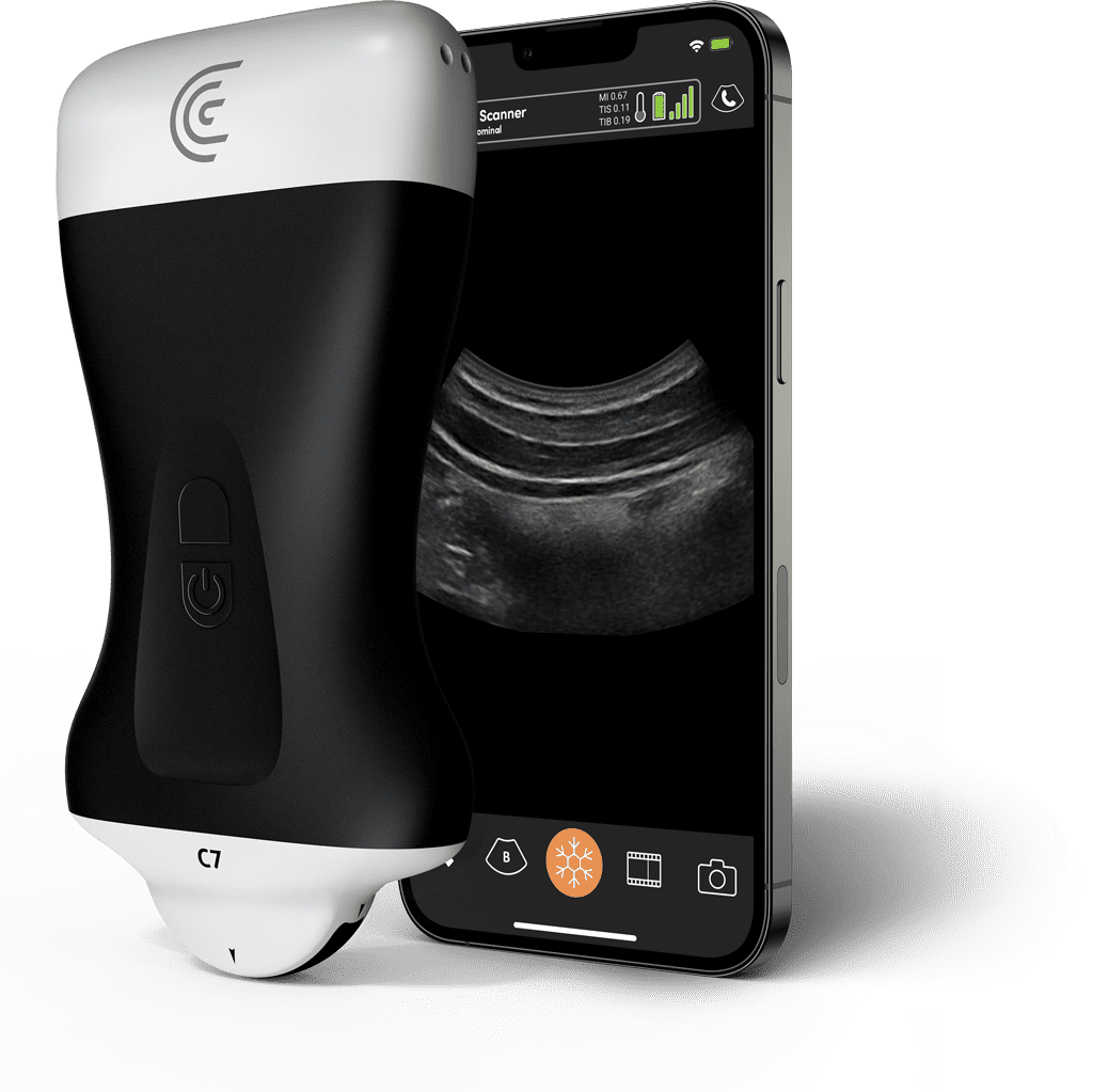 Microconvex Ultrasound Scanner Clarius