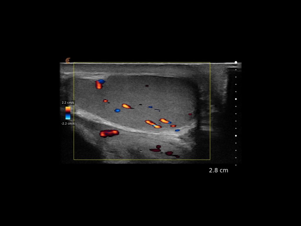CFI Testi - clinical image