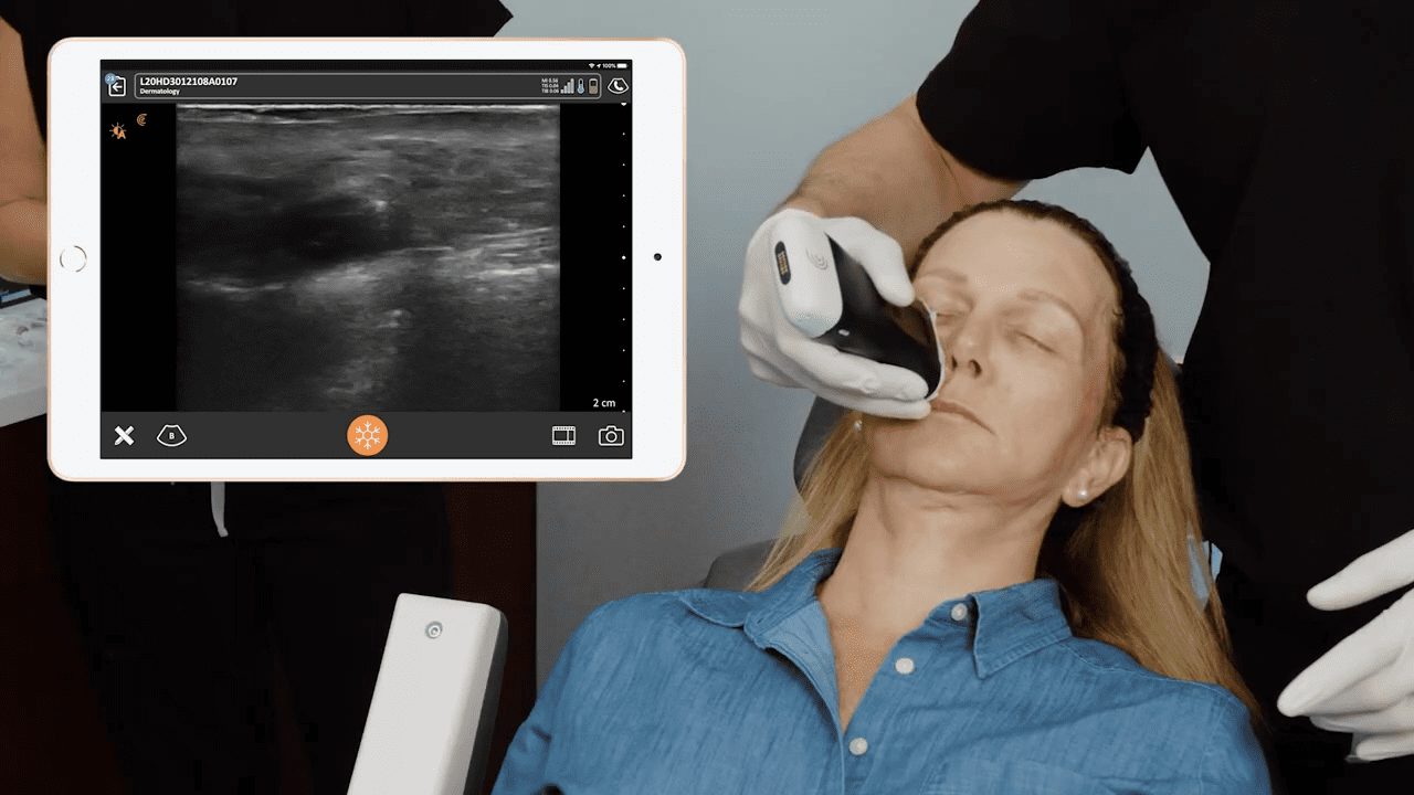 Piriformis Injection Main Line Spine vrogue.co