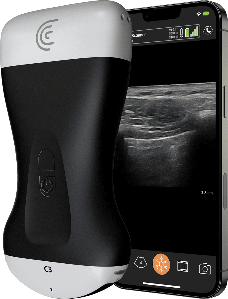 Clarius HD Portable Ultrasound Machine | Clarius