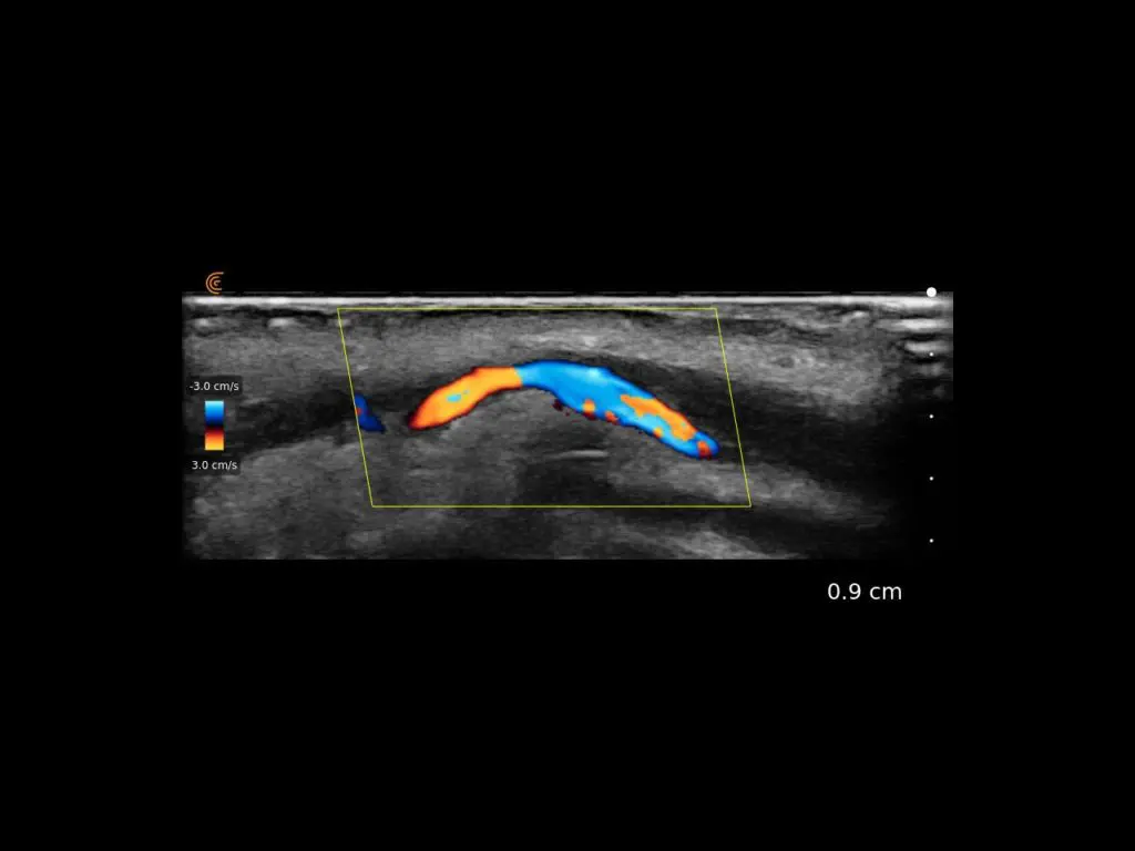 Superior labial artery