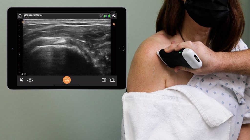 Ultrasound-Shoulder-Fritz