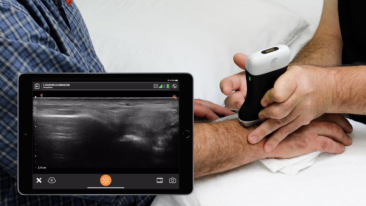 Ultrasound-Wrist-Fritz