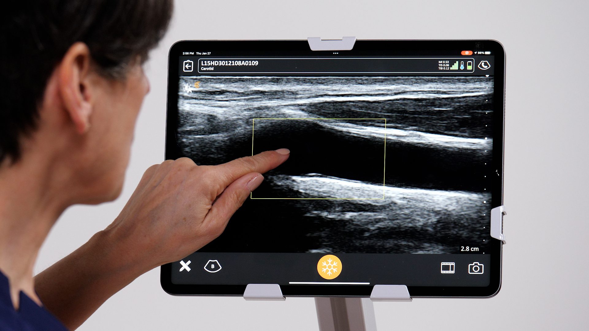 How to Zoom an Image Clarius