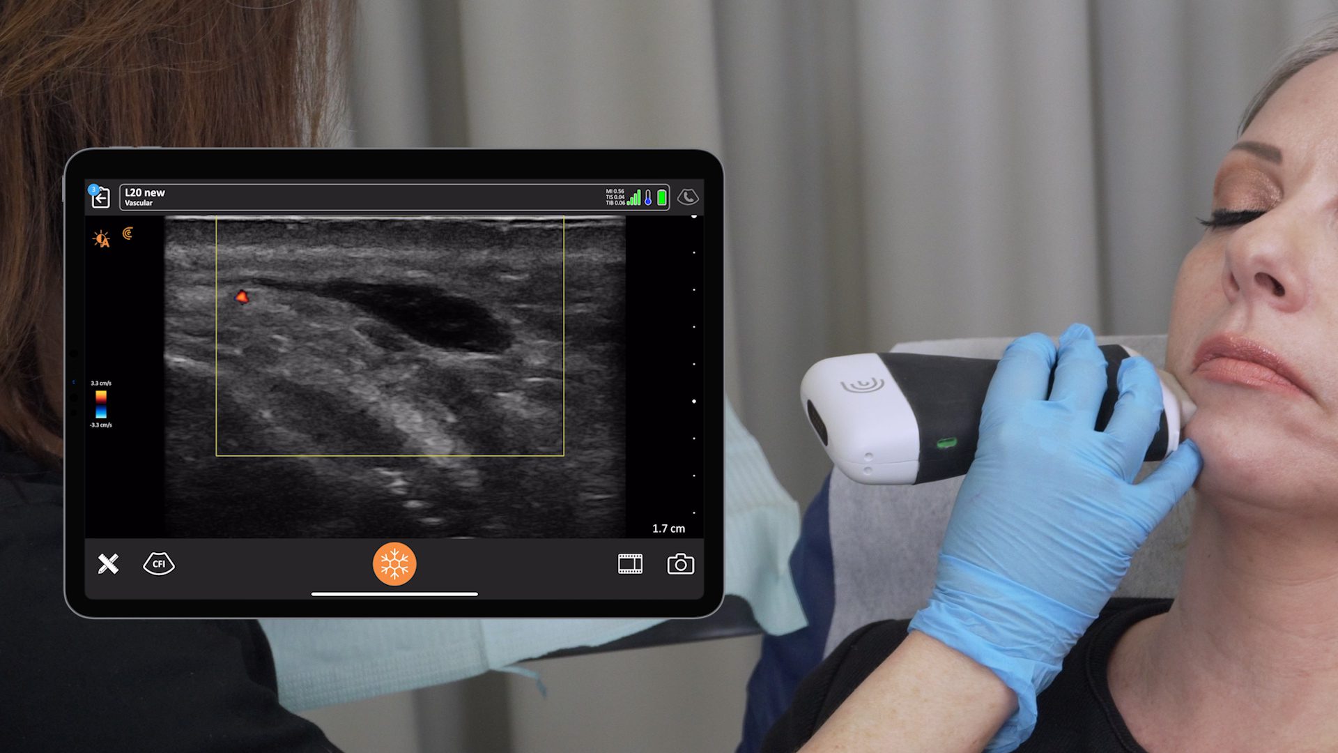 Line Injection Clarius