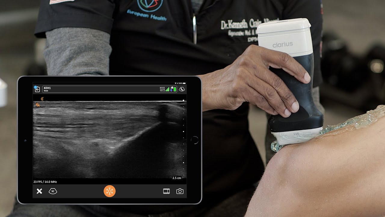 Post_exertion_knee_Scan